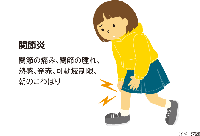 関節炎　関節の痛み、関節の腫れ、熱感、発赤、可動域制限、朝のこわばり　イメージ図