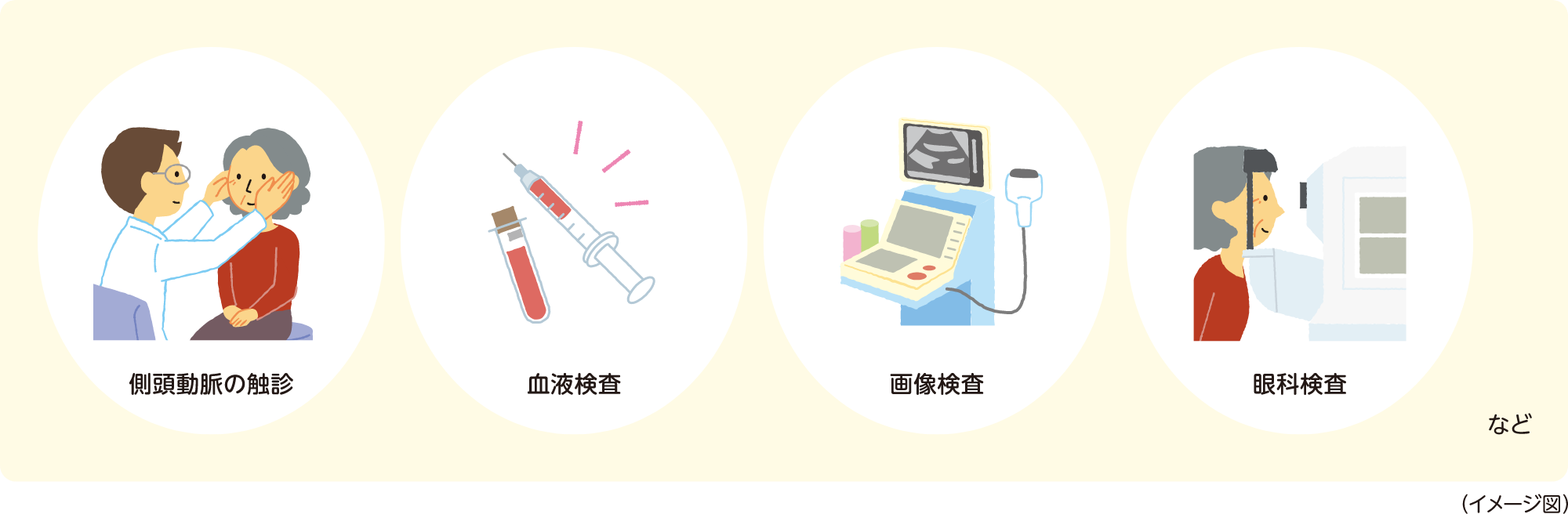 側頭動脈の触診 血液検査 画像検査 眼科検査など イメージ図